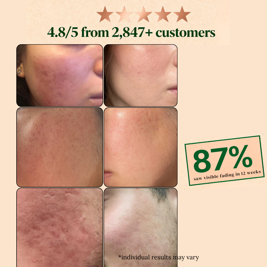 The Complete Scar Fading Trio