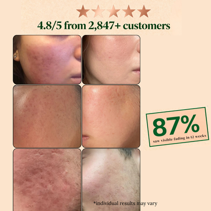 The Complete Scar Fading Trio