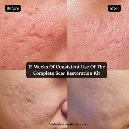 The Complete Scar Fading Trio